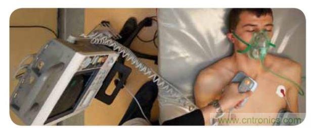 帶電極的醫(yī)院用除顫器。注意，患者身上有外部心電圖或心臟監(jiān)護(hù)儀，從胸部的白色圓片(電極)和導(dǎo)聯(lián)(線)可看出來(lái)。